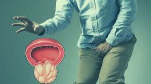 Akute Prostatitis
